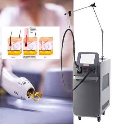 755 طول موج پالس بلند Nd-Yag 1064nm لیزر الکساندریت برای استفاده تجاری