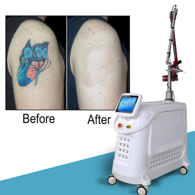 4 طول موج Nd YAG Q Switch Laser Machine حذف خالکوبی سبک ثابت