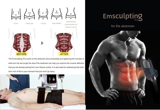 دستگاه لاغری پیشرفته EMS فرکانس 150HZ برای کاهش سلولیت