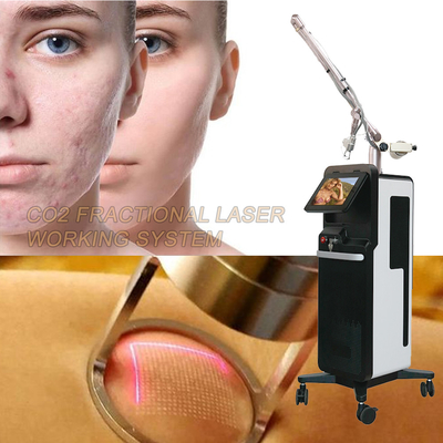 ماشین لیزری CO2 حرفه ای برای بازسازی سطح پوست